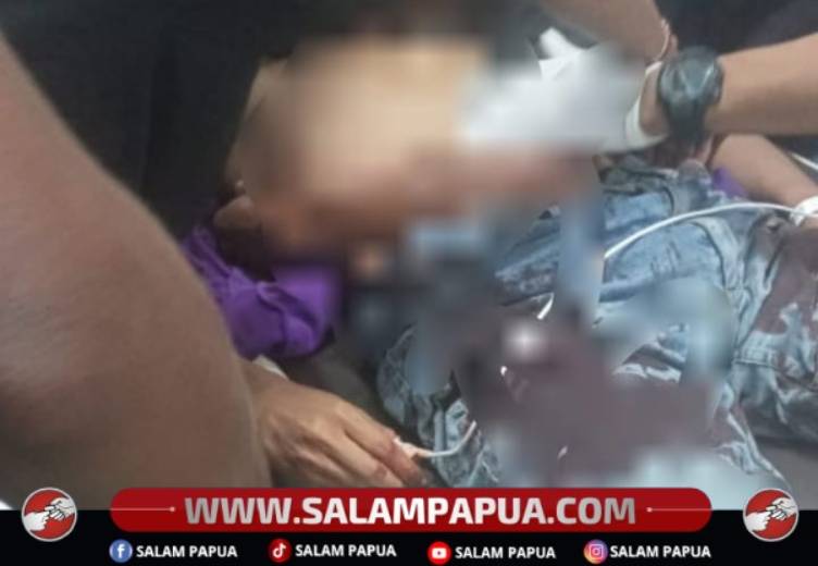 Remaja Kritis Usai Aksi Motor Berdiri, Tabrak Pejalan Kaki Dan Tembok