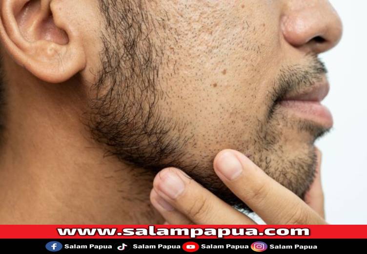 Jambang, Cara Merawat Dan Mendukung Pertumbuhannya