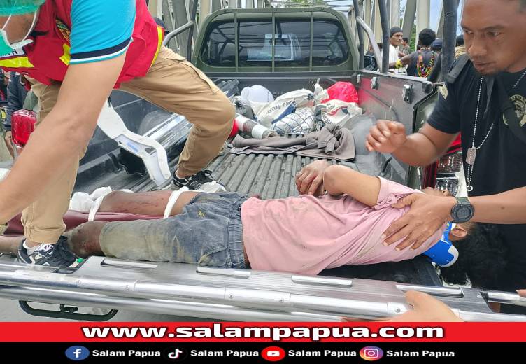 Laka Tunggal Di Jembatan Waker, Pengemudi Pick Up Patah Kaki