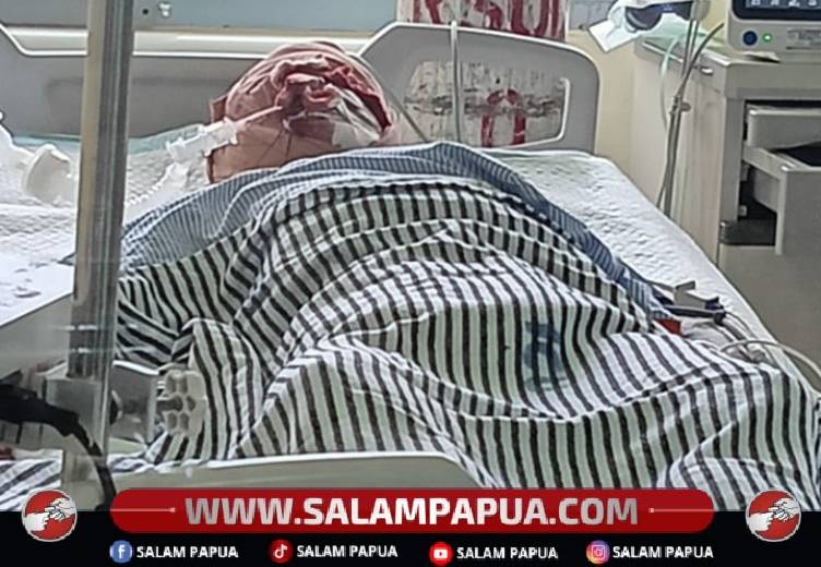 Polisi Pastikan Pelaku Penganiayaan Afdal Jaya Diproses Hukum