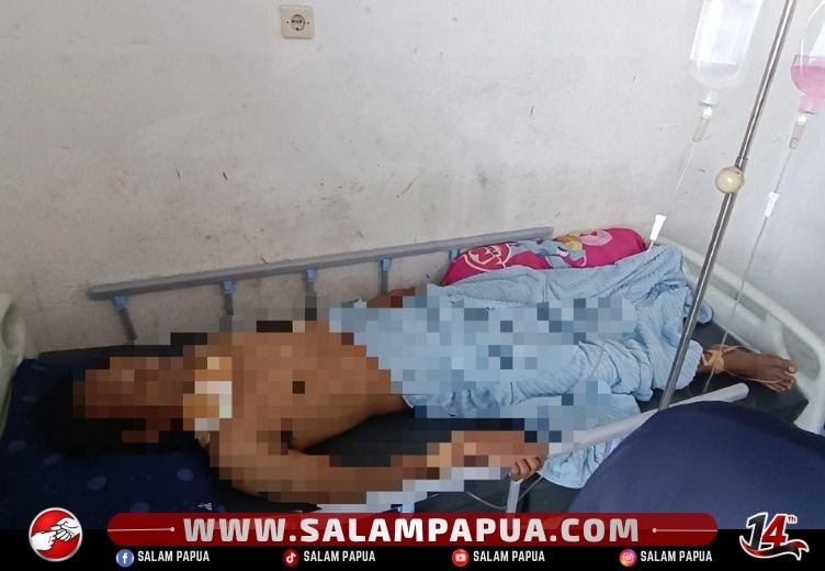 Warga Sipil Jadi Korban Penganiayaan Berat Di Yahukimo, Aparat Kejar Pelaku Diduga KKB