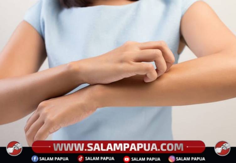 Memahami Masa Inkubasi DBD